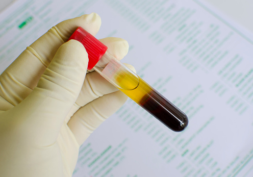 A Lyme-szerológia (lassú) trónfosztása